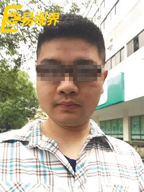 洛陽(yáng)小伙因視力落榜  視力健康不容忽視