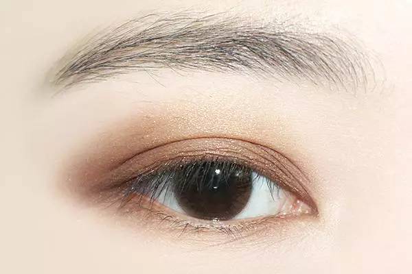 近視度數(shù)不斷增加或致盲