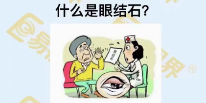什么是眼結石